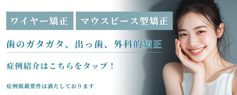 ワイヤー矯正やマウスピース矯正の症例紹介